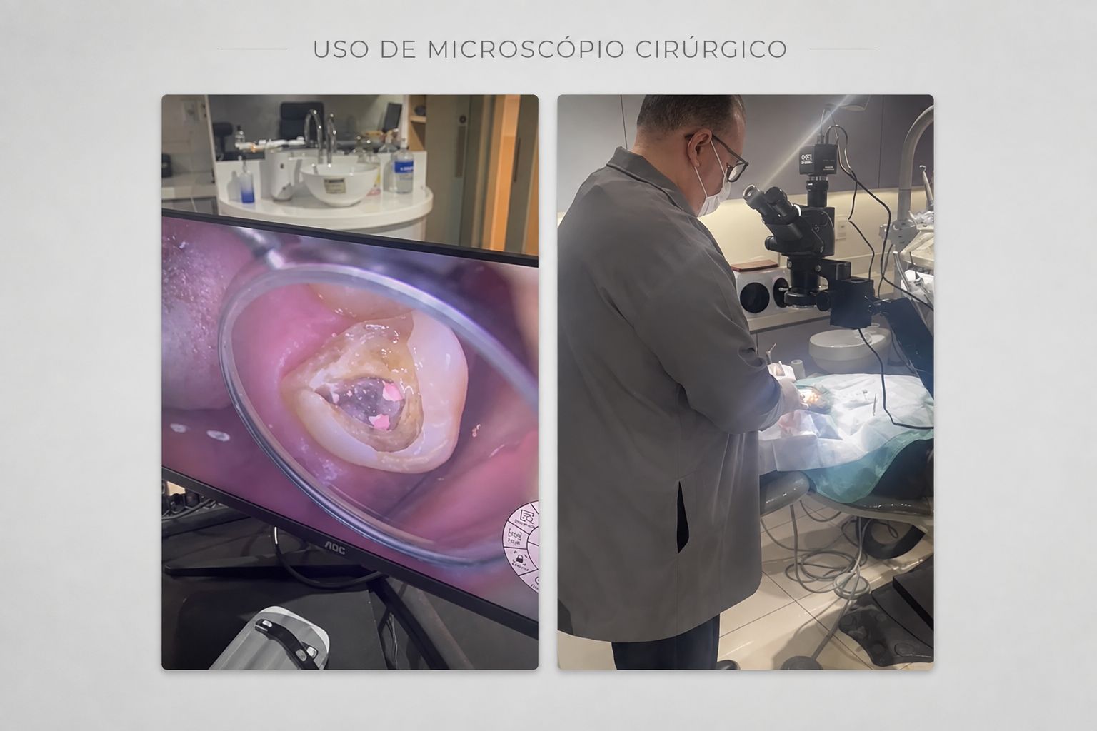 Uso de microscópio cirúrgico durante procedimento odontológico